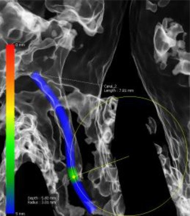 Green X von orangedental Endo Aufnahme