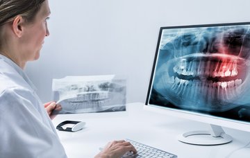 Röntgengeräte für Zahnärzte